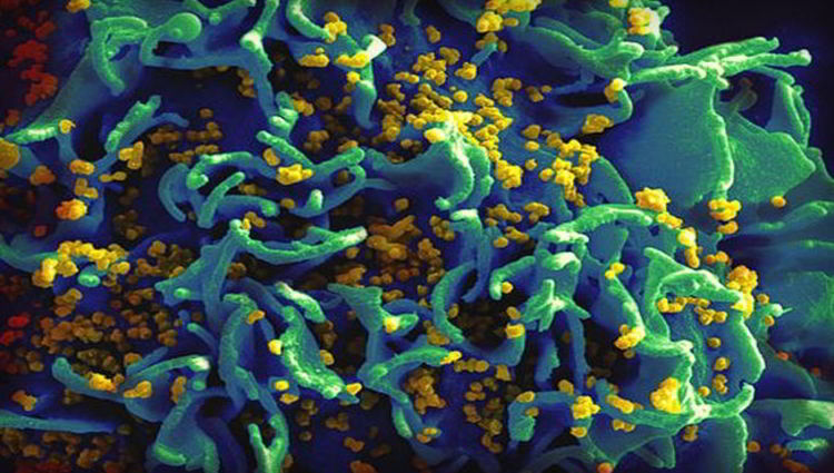 Suntikan Tunggal Antibodi Berhasil Melindungi Monyet dari Virus HIV Selama 6 Bulan
