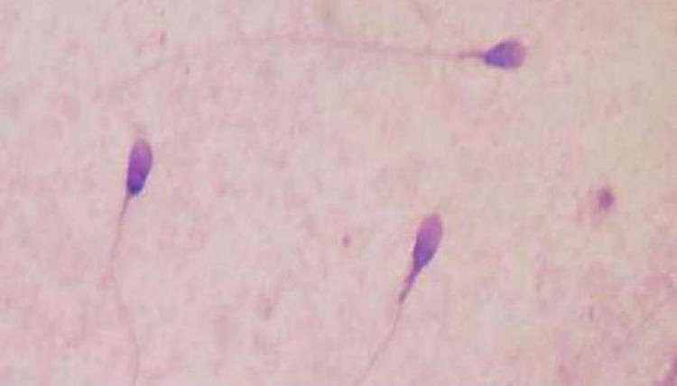 Ilmuwan Berhasil Membuat Sperma dari Sel Kulit Manusia