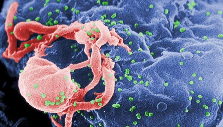 Transplantasi Organ yang Terkena HIV dapat Dilakukan